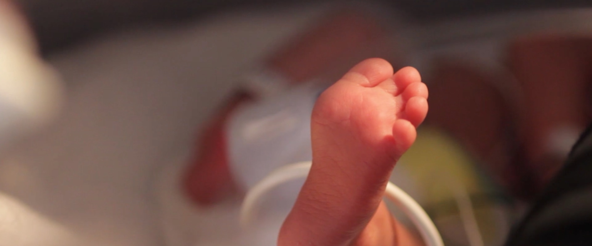 Expert Insights: Understanding Birth Injuries and Their Impact on Newborns