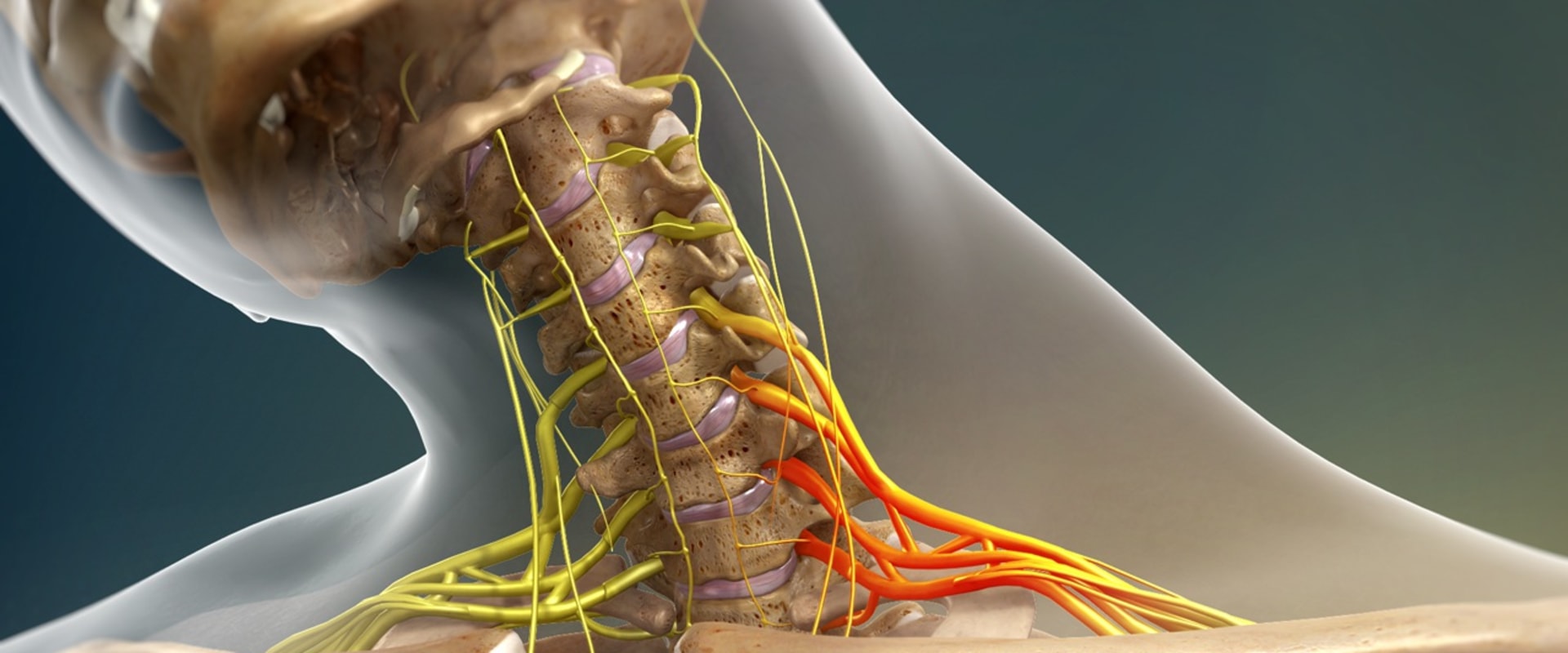 Understanding Brachial Plexus Injuries: Causes, Symptoms, and Treatment