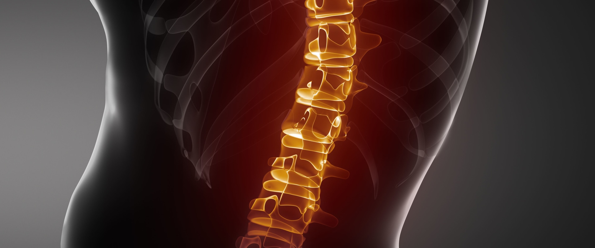 The Long-Term Effects of Spinal Injuries at Birth