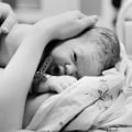 Expert Insights: Understanding and Treating Birth Injuries