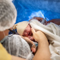 Understanding the Complications of Birth Injuries