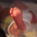 Expert Insights: Understanding Birth Injuries and Their Impact on Newborns