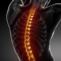 The Long-Term Effects of Spinal Injuries at Birth