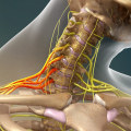 Understanding Brachial Plexus Injuries: Causes, Symptoms, and Treatment