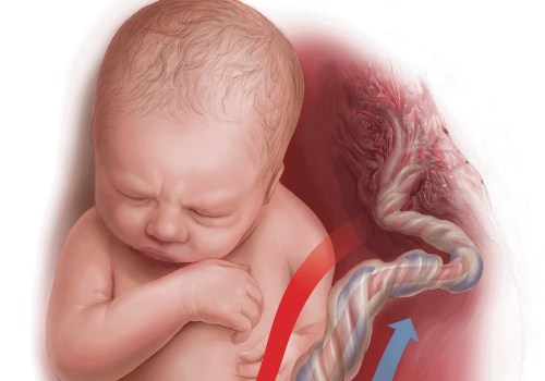 The Impact of Birth Injury on the Fetus