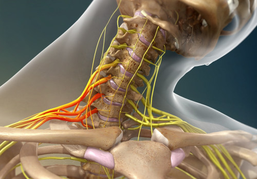 Understanding Brachial Plexus Injuries: Causes, Symptoms, and Treatment